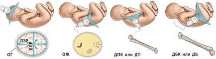 Какво е плод на LZR
