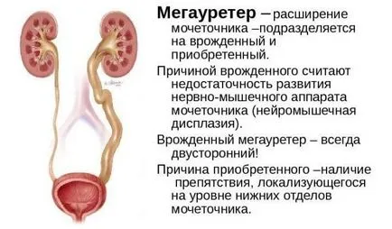 лечение на бъбреците при деца