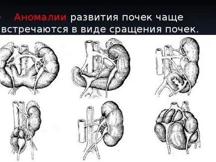 лечение на бъбреците при деца