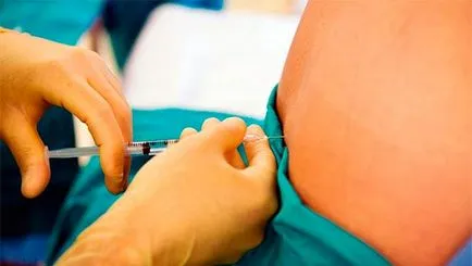 Hysteroresectoscopy какво е