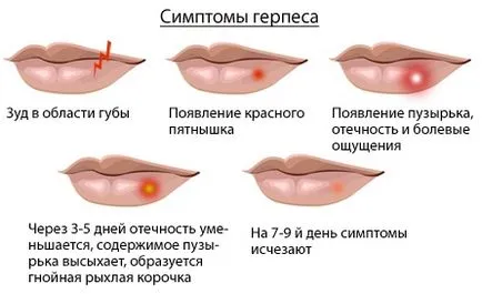 Херпес при мъжете и как