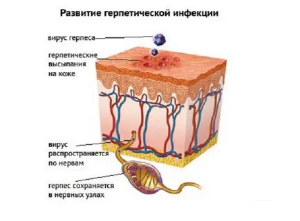 Херпес при мъжете и как