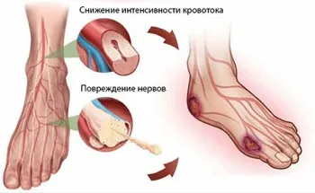Ход при мъжете