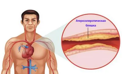 Ход при мъжете