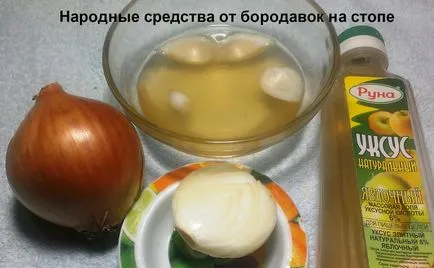Как да се отървете от брадавици Как да се отървете от брадавици