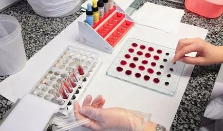 Какво определя кръвната група