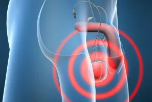 HPV férfiaknál HPV férfiaknál