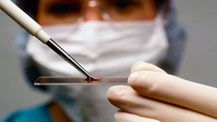 Elemzés antibiotikumok vér Elemzés antibiotikumok vér