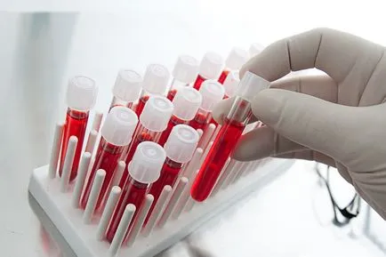 Elemzés antibiotikumok vér Elemzés antibiotikumok vér
