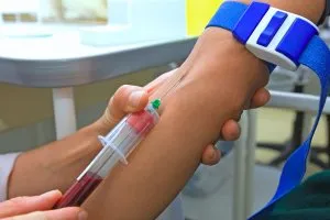 Как да премине тестовете на щитовидната жлеза