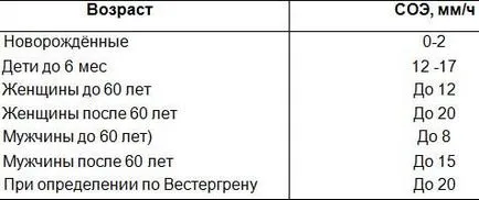 Как да се подобри скоростта на утаяване в анализите Как да се подобри скоростта на утаяване в анализите