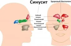 Уши как да извадите щепсела от ухото