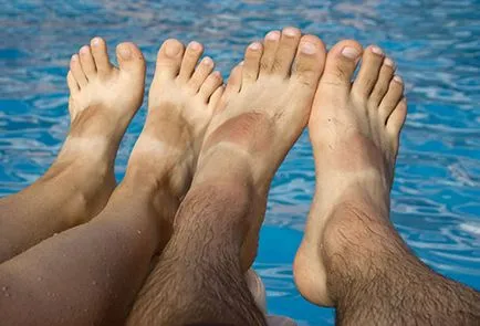 Melyek a szőr a fejen Melyek a szőr a fejen