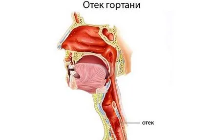 Суха кашлица, без да го треска