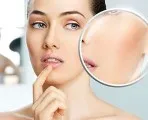 розацея козметика