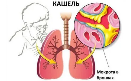 Какво е муколитичен агент