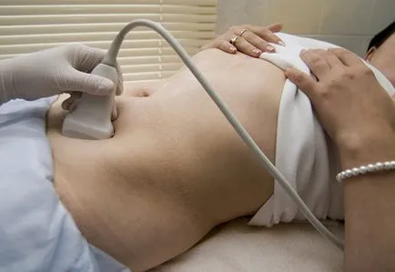 Какво е multifollikulyarny яйчниците Какво е multifollikulyarny яйчниците