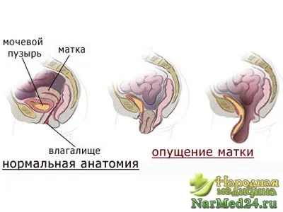 Какво се пада на матката