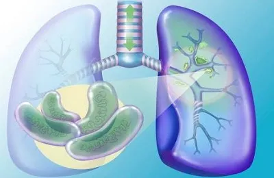A zárt forma tuberkulózis, hogy ez A zárt forma tuberkulózis, hogy ez