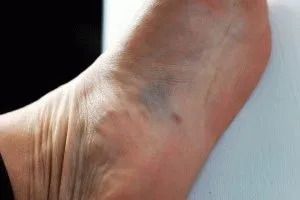 Защо плюшен крака