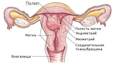Hysteroresectoscopy какво е