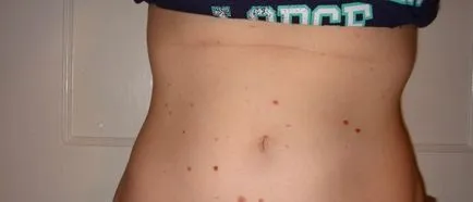 Петното кърви, че правя Петното кърви, че правя