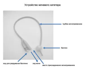 Как да се измие на катетъра