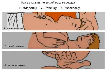 Как да се коригира сърдечен масаж