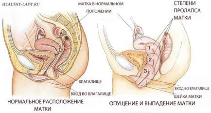 Какво се пада на матката