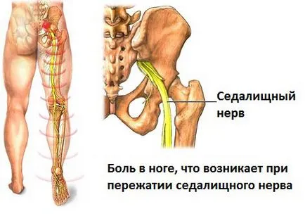 Каква е симптом Lasegue