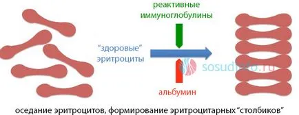 скорост на утаяване на еритроцитите за това какво е
