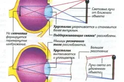 Какво е cyclospasm