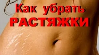 Средства за стрии