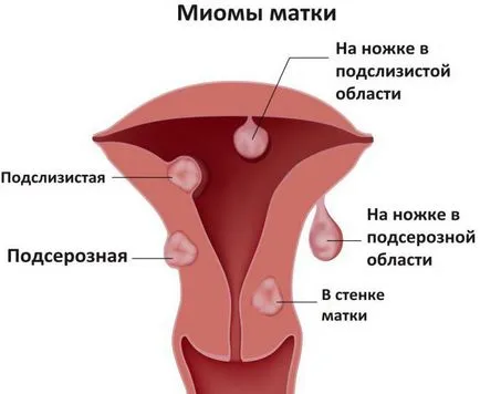 Както е добре, можете да направите