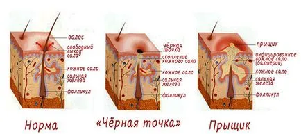 Акнето по лицето у дома