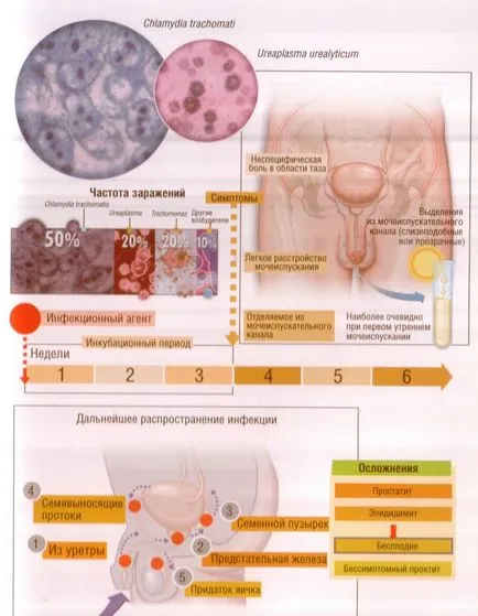 Всички ureaplasmosis лечение