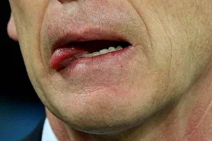 лечение Зайед на дете лечение Зайед на дете