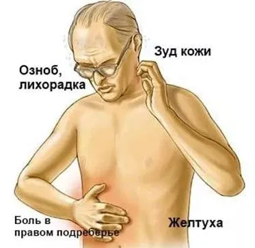 Как да се отървем от жлъчката Как да се отървем от жлъчката