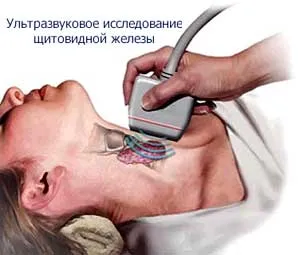 автоимунна тиреоидит