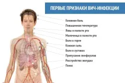 Какво е различното при СПИН от ХИВ симптоми инфекция и лечение, профилактика