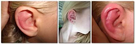 Какво става, ако подути ухото отвътре, отвън, лоб, в района на челюстта
