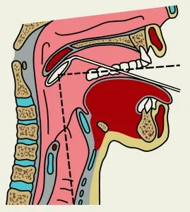 Какво е pharyngoscope гърлото видове медицина, индикации за изследване