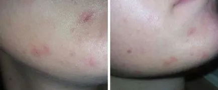 Какво е скраб за лице и тяло, как работи, ефективност