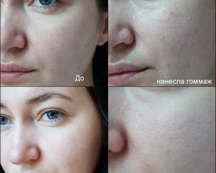 Какво е скраб за лице и тяло, как работи, ефективност