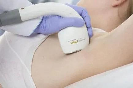 Waxing & Обезкосмяване мишниците 7 начина за премахване на косата в подмишниците