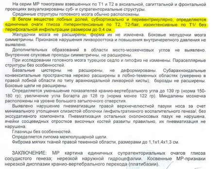 Индивидуални лезии в бялото вещество на мозъка - резултатите от ядрено-магнитен резонанс