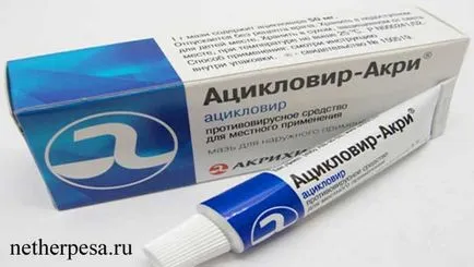 Херпес на ръцете диагноза, симптоми, лечение