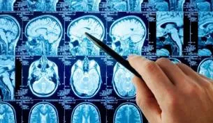 Исхемична и хеморагичен инсулт