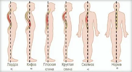 Колко бързо се оправям си стойка, като у дома си (поза) Колко бързо се оправям си стойка, като у дома си