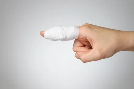 Как за лечение на абсцес на неговите пръст народни методи